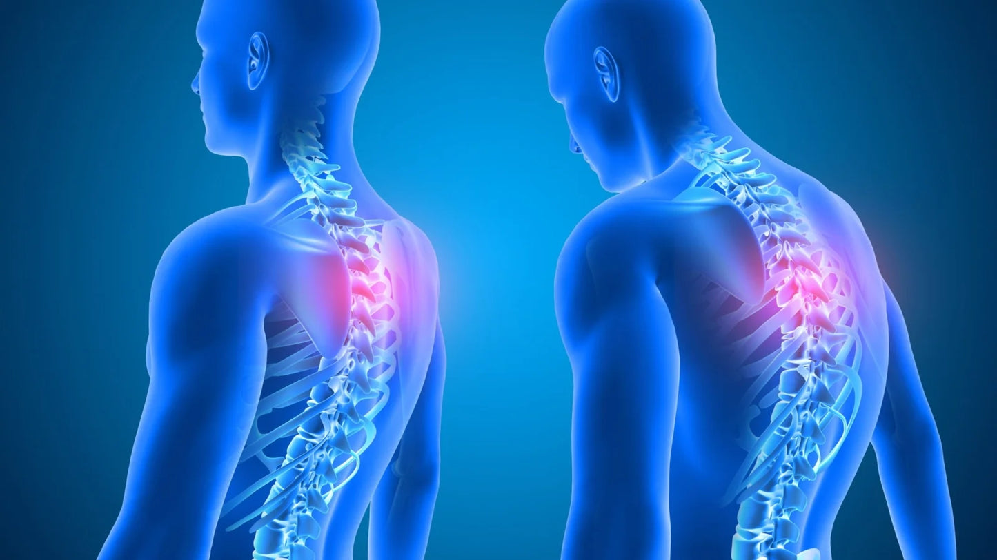 SmartPos - Corrector de Postura Inteligente